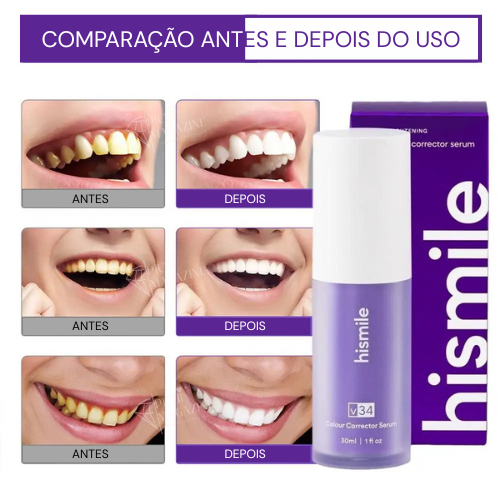 Clareador Dentário Sérum Hismile V34™ 30ml | 3 em 1