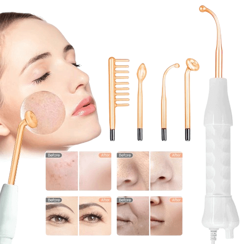 Aparelho de Alta Frequência Portátil 4 Eletrodos – Facial e Capilar