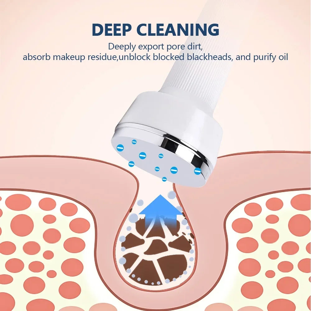 Aparelho Ultrassom HU-638 Supersonic Com Jato De Plasma Alta Frequência 3 Em 1