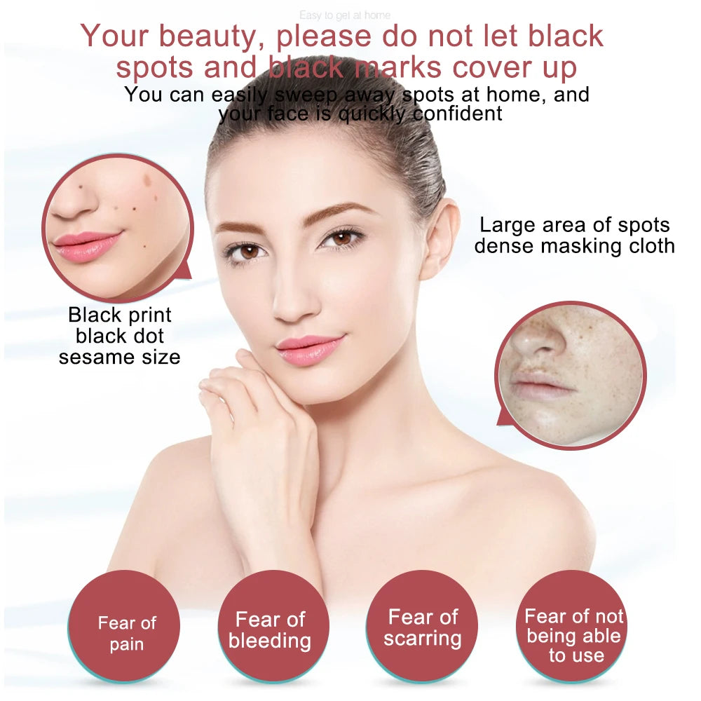 Caneta Jato de Plasma Digital 9 Níveis - Recarregável | Removedora de Verrugas e Manchas