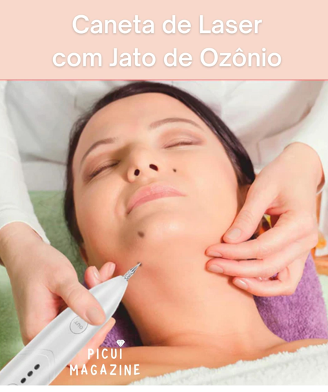 Skin Care Laser - Caneta Ion Elétrica Para Remoção de Sinais, Manchas, Verrugas... - Picuí Magazine